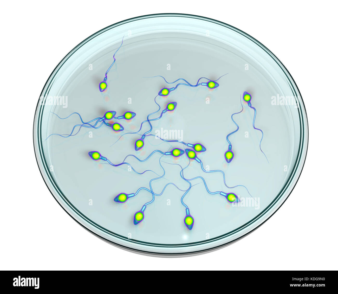 Concepto de fertilización in vitro. Ilustración que muestra el equipo en una caja de petri spermatozoans esperando a ser utilizado para fertilizar un óvulo. Foto de stock
