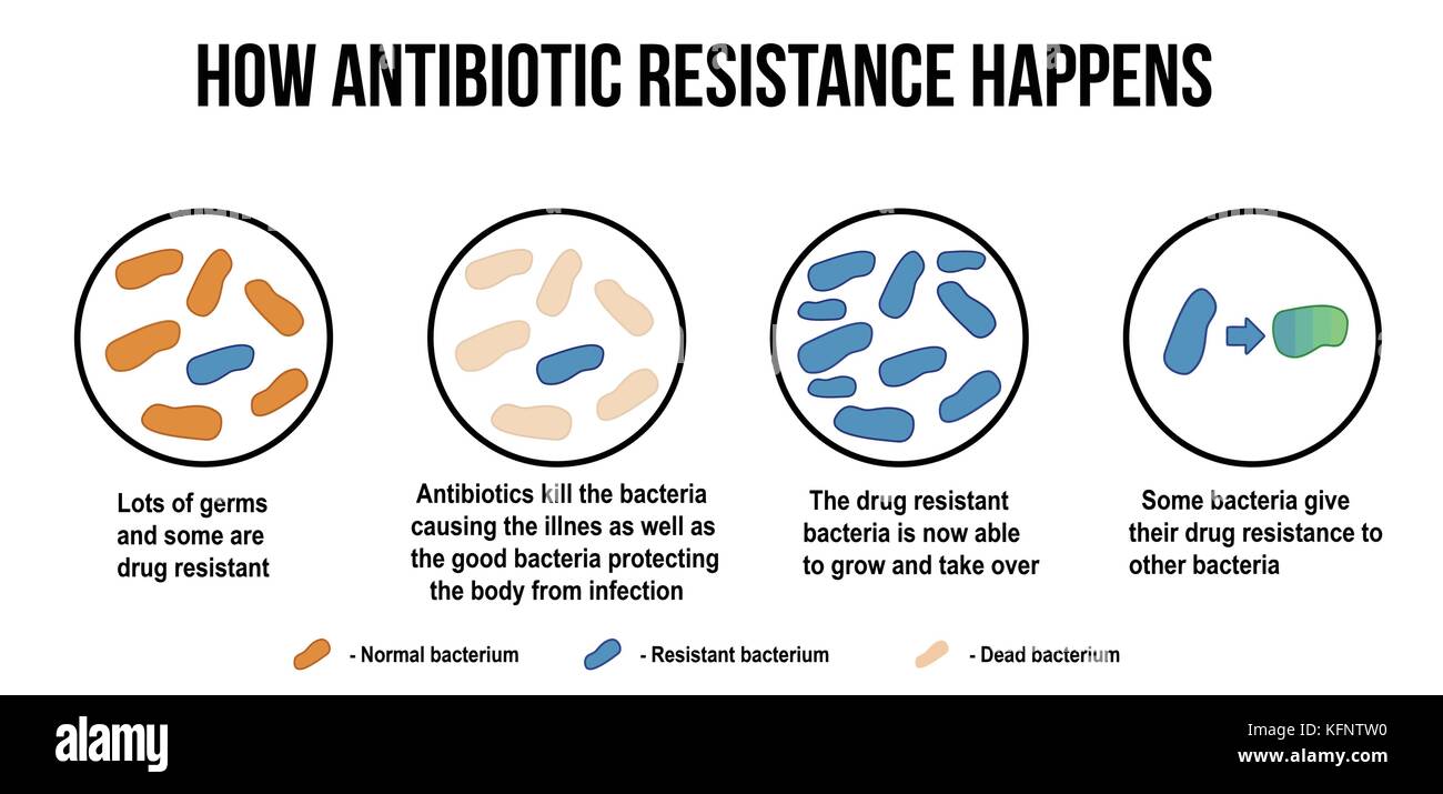 Cómo ocurre la resistencia a antibióticos, diagrama de ilustración vectorial (para educación médica básica, para las clínicas y escuelas). Ilustración del Vector