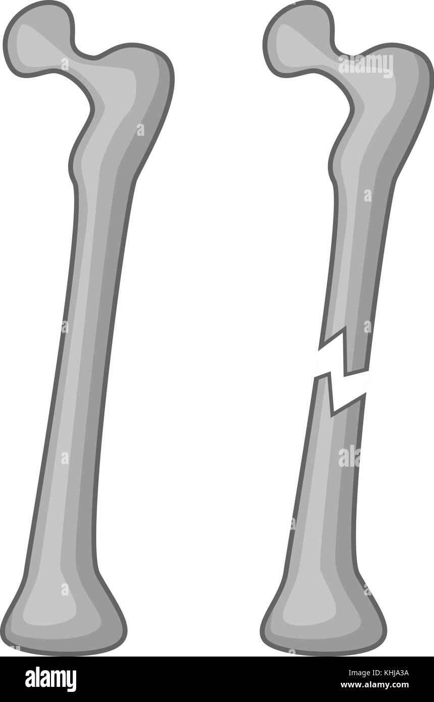 Icono de un hueso roto, estilo de dibujos animados Imagen Vector de stock -  Alamy