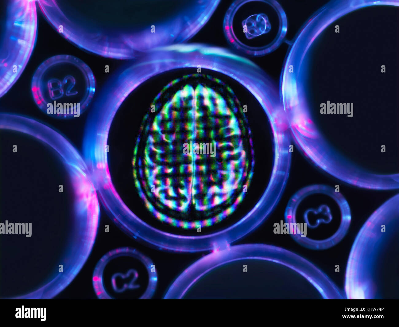 Investigación de Alzheimer y demencia, una exploración cerebral en bandeja de múltiples pocillos utilizada para experimentos de investigación en laboratorio Foto de stock
