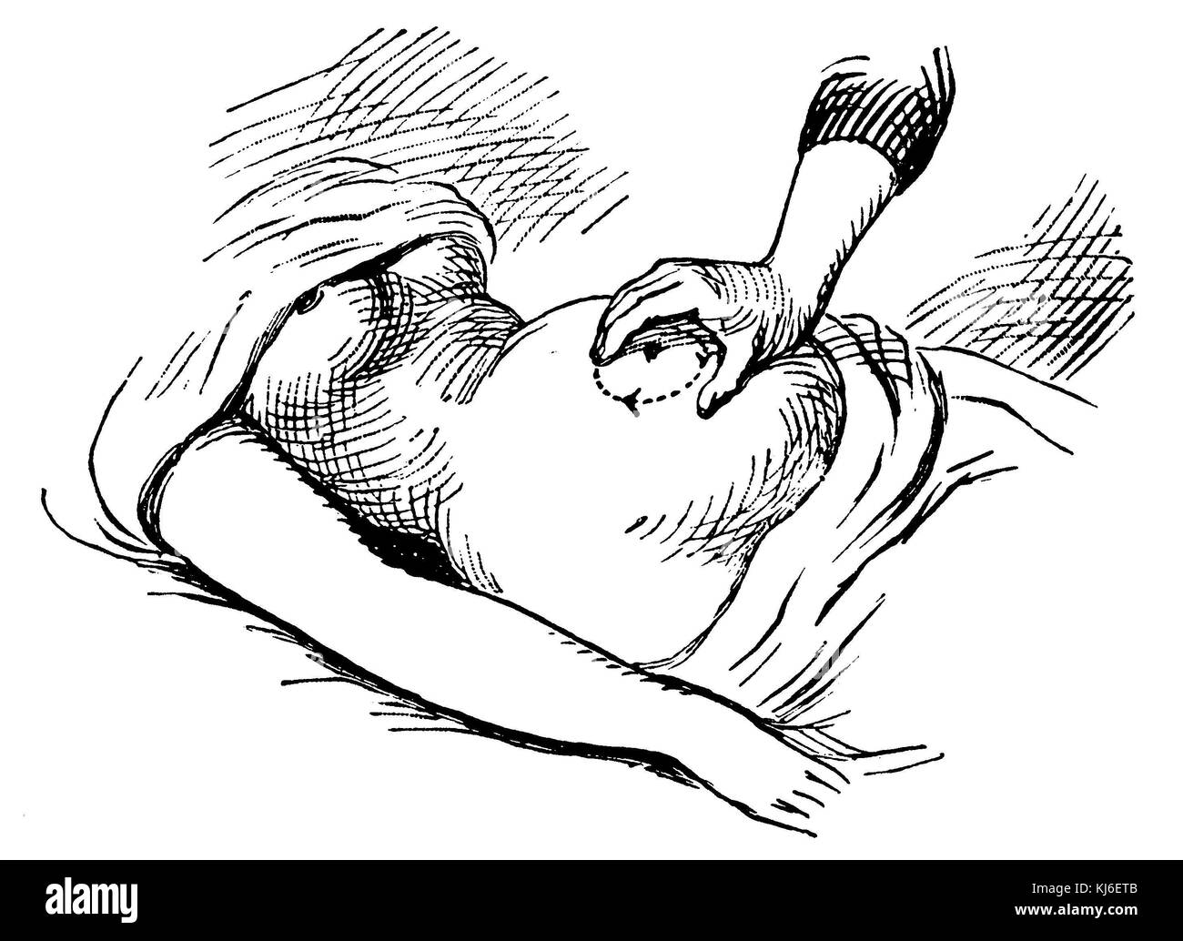 Nacimiento: Masaje del útero embarazada (Geburt: Massage der schwangeren Gebärmutter) Foto de stock
