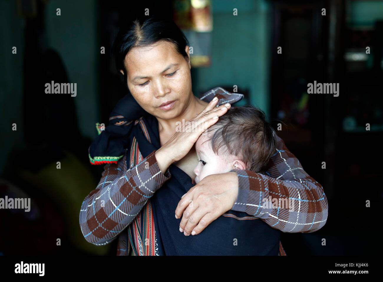 Madre y su joven enfermo de enfermedad del corazón. Kon Tum. Vietnam. Foto de stock