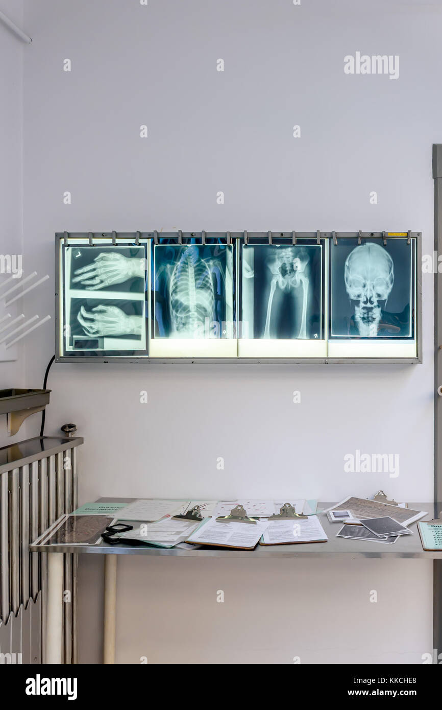Las imágenes de rayos x en la oficina de un radiólogo Foto de stock