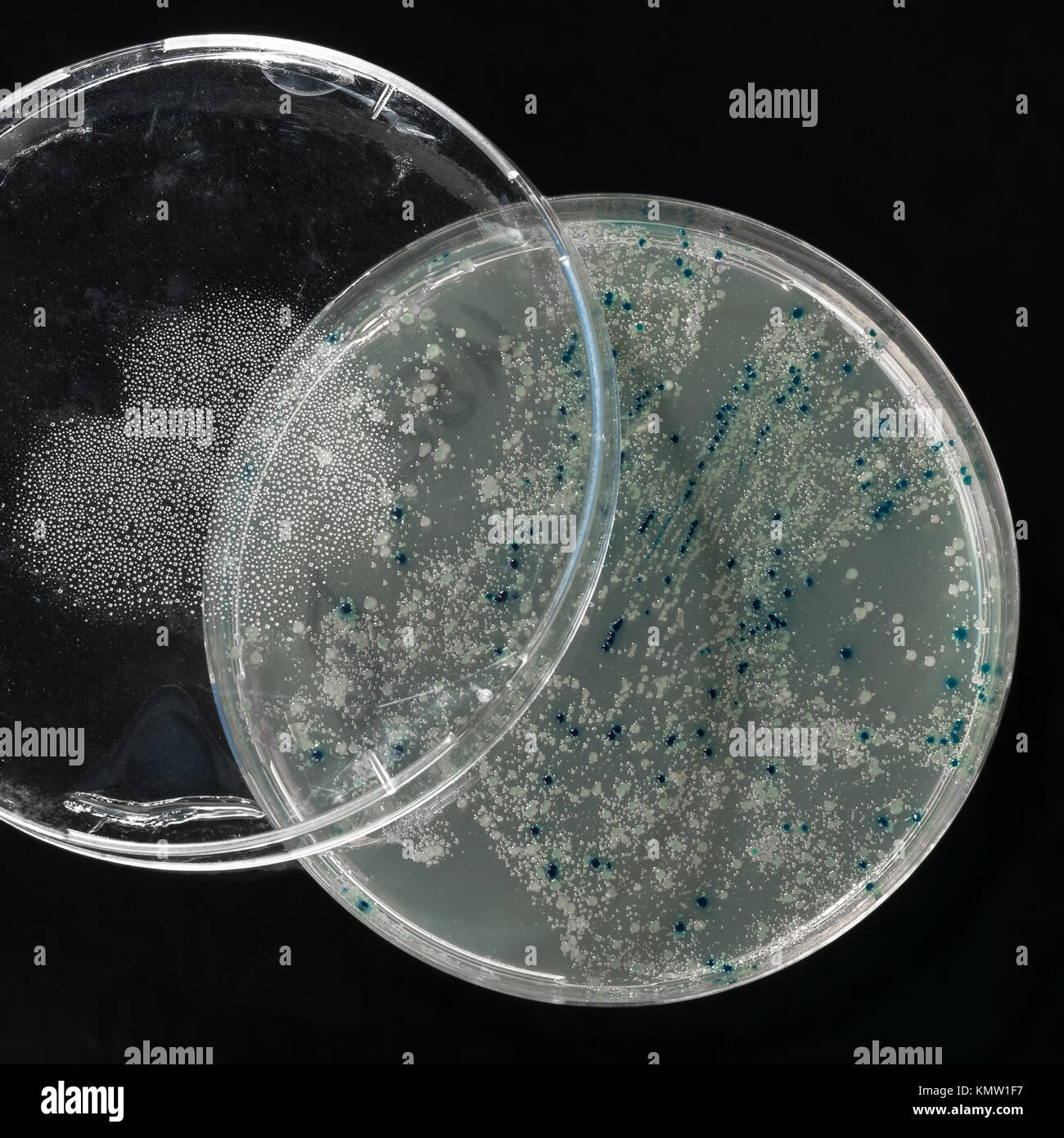 Placa de agar con colonias de bacterias para vector plasmídico clonación sobre fondo oscuro Foto de stock