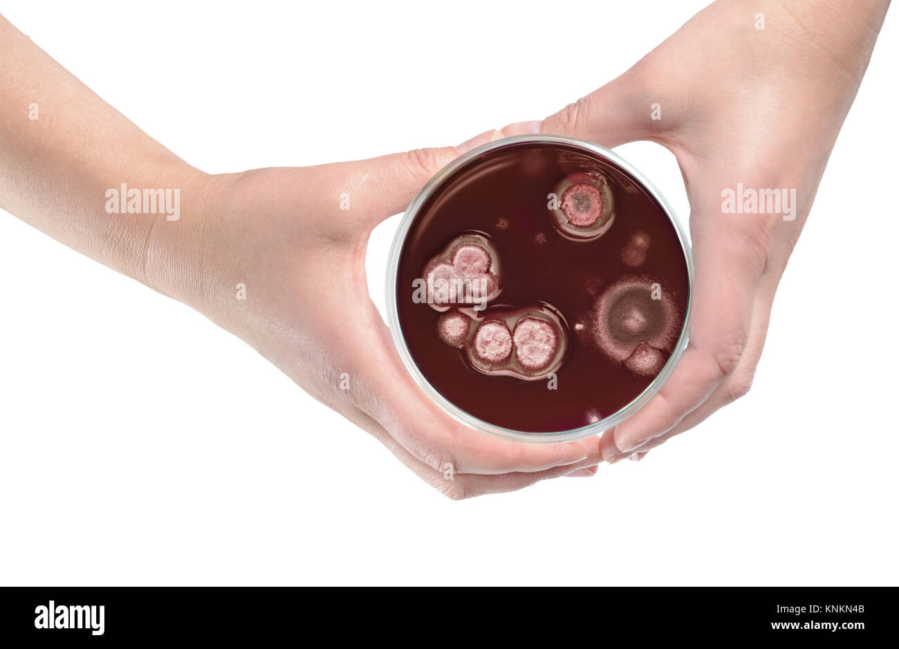 Mantenga las manos plato que contiene las colonias de bacterias. Aislado sobre fondo blanco. Foto de stock
