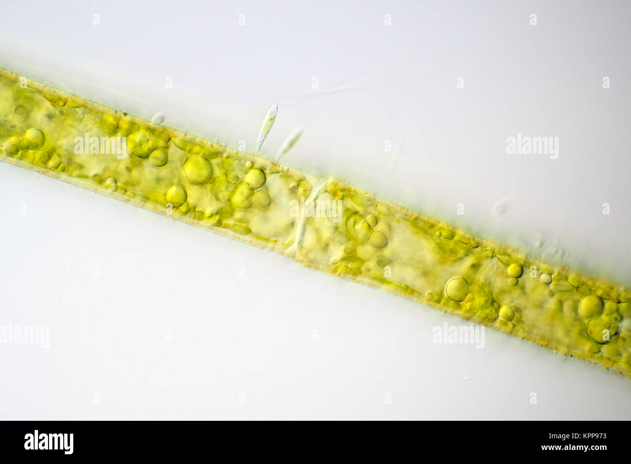 Brillante campo microfotografía de células de algas filamentosas, alga Characium adjunta foto de superficie es de unos 160 micrómetros de ancho Foto de stock