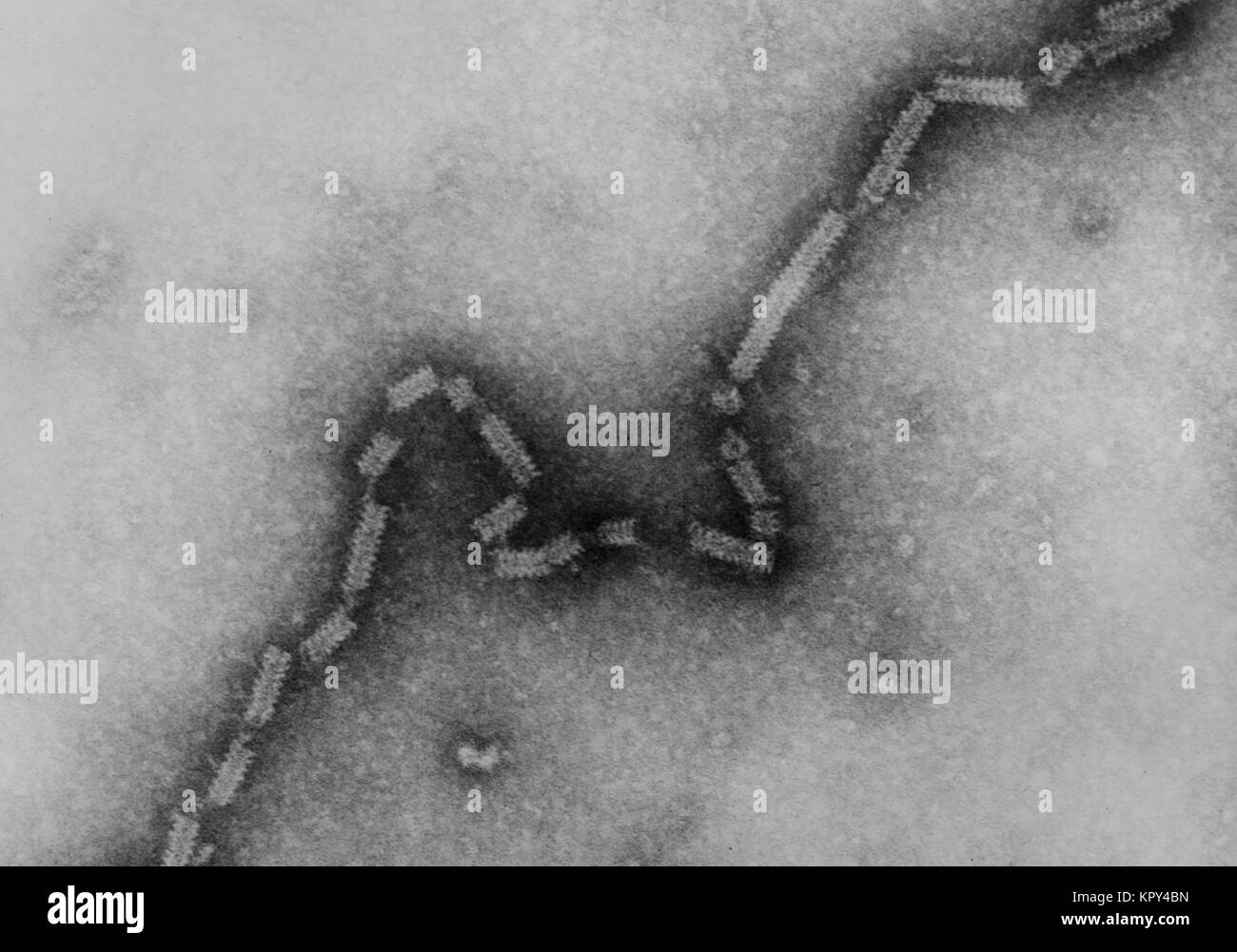 Micrografía de electrones del paramixovirus 4A nucleocapsid con su núcleo de ARN en forma de espina de pez, 1975. Foto de stock