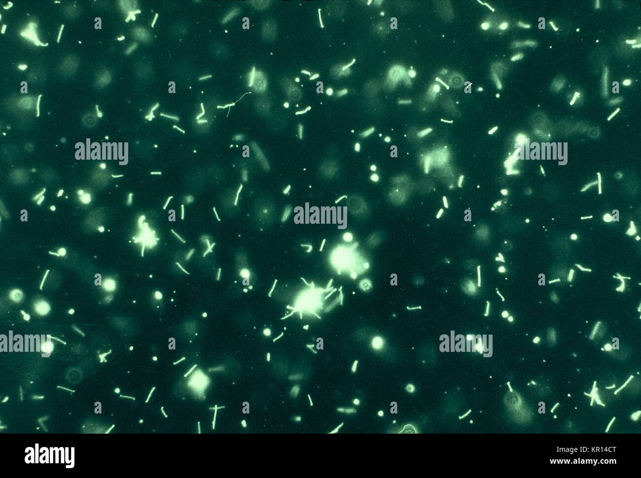 Microfotografía de leptospira la prueba de aglutinación microscópica con antígeno vivo mediante la técnica de microscopía de campo oscuro, 1961. La Leptospirosis es una enfermedad zoonótica común global del hombre y varios animales de sangre caliente, especialmente en los sub-regiones tropicales del mundo, causada por la espiroqueta Leptospira . Imagen cortesía de CDC/Sra. M Gatton. Foto de stock