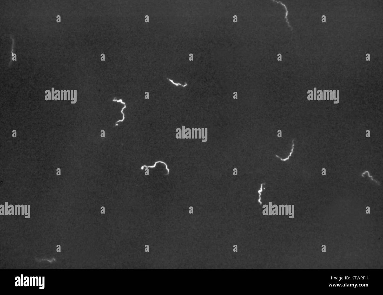 Microfotografía de campo oscuro de la bacteria Treponema pallidum. Control deslizante de Nichol, la cepa de T. pallidum desde un testículo de conejo, y coloreadas por la técnica de anticuerpos fluorescentes, ampliación 54X, 1971. La tasa de sífilis primaria y secundaria en los EE.UU. disminuyó el 89,2 por ciento de 1990 a 2000. Imagen cortesía de CDC/C.W. Hubbard. Foto de stock