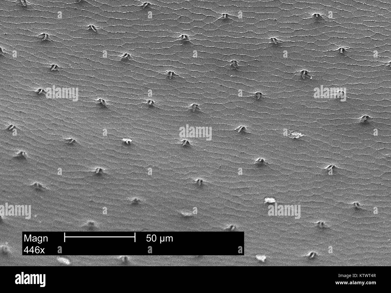 Este es un análisis micrografía de electrones (SEM) de la shell chitinous que cubre la parte posterior de una mariquita magnificados 446X. Nota la fusión de las antiguas escalas de que se compone la coraza protectora, así como el pequeño, el pelo-como las proyecciones que salen de los poros dentro de este manto. Imagen cortesía de CDC, 2002. Foto de stock