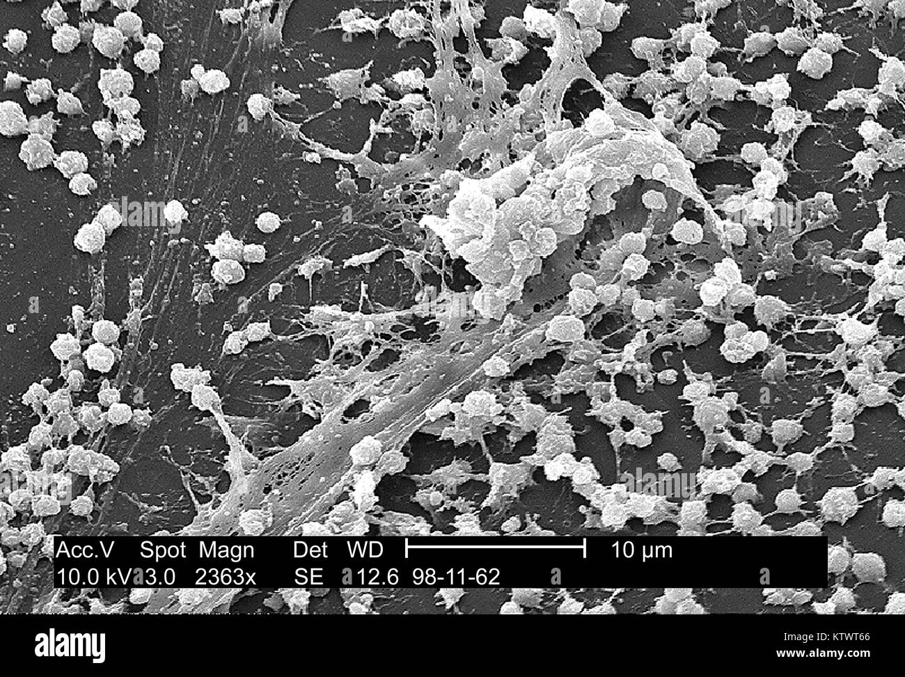 Análisis micrografía de electrones (SEM) de un Staphylococcus biofilm en la superficie interior de un conector needleless. Una característica distintiva de las biopelículas es la presencia de sustancias poliméricas extracelulares, principalmente polisacáridos, rodeando y encajonan las celdas. Aquí, estos polisacáridos han sido visualizada por microscopía electrónica de barrido. Imagen cortesía de CDC/Dr. Rodney M. Donlan, 2002. Foto de stock