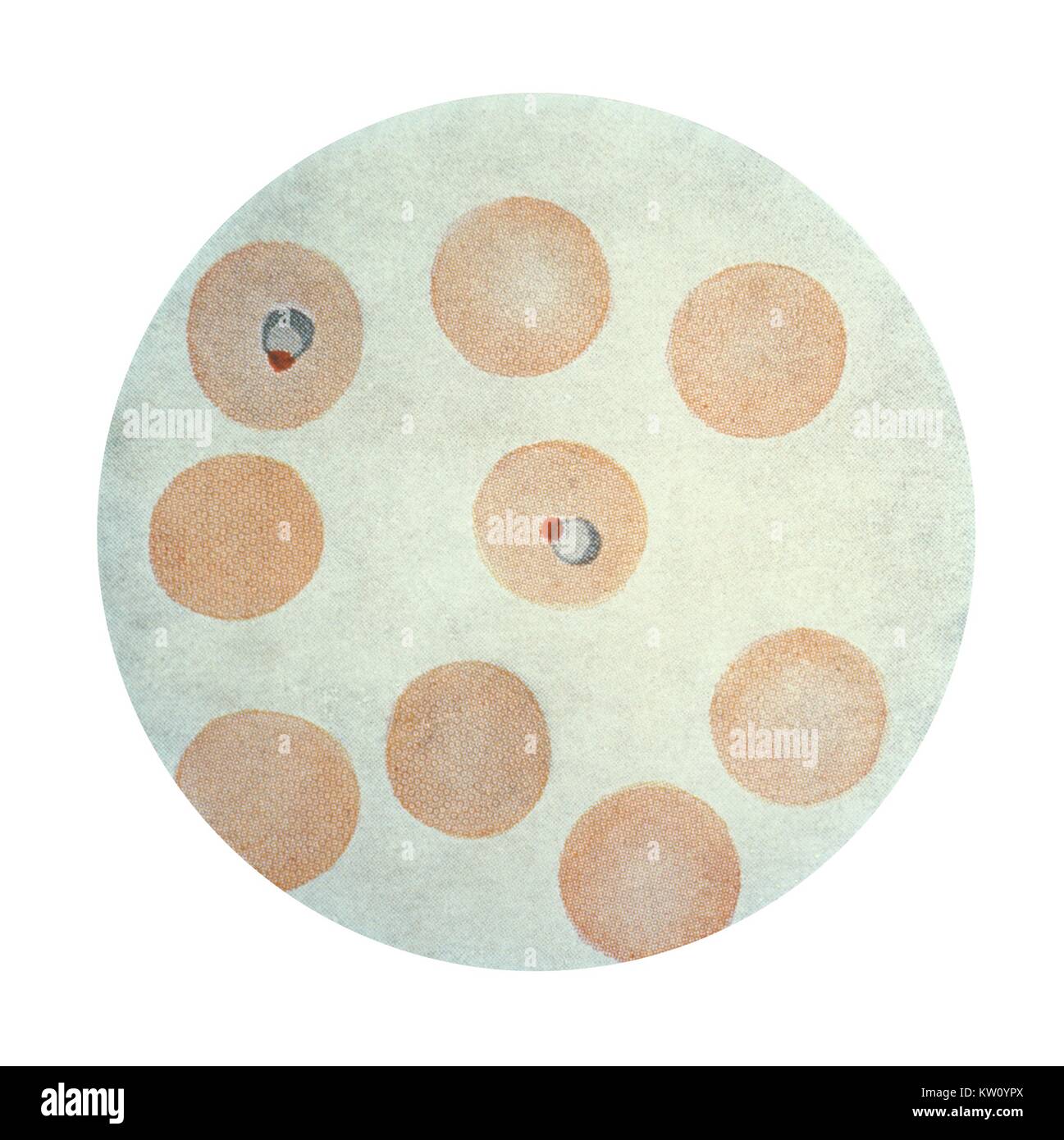Esta es una microfotografía de un Plasmodium malariae trofozoitos en el ring escenario mediante tinción de Wright. (X1500), P. malariae, un quartan malaria, produce paroxismos febriles en un ciclo de 72 horas. Las recaídas pueden ocurrir a veces medio siglo después de ser infectados. Imagen cortesía de CDC, 1979. Foto de stock
