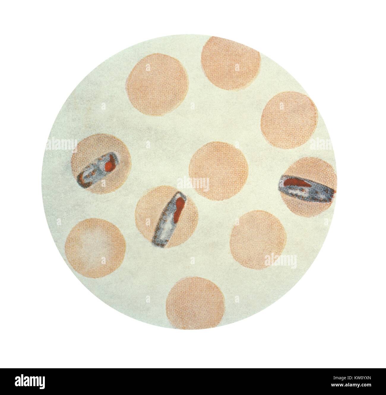 Esta ilustración muestra el Plasmodium malariae en su etapa schizont eritrocitarios mediante tinción de Wright, magnificada x1500. P. malariae, paludismo, quartan produce paroxismos febriles en un ciclo de 72 horas. Las recaídas pueden ocurrir a veces medio siglo después de ser infectados. Imagen cortesía de CDC, 1979. Foto de stock
