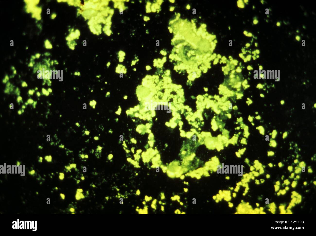 Tinción de anticuerpos fluorescentes de Yersinia pestis. La peste, causada  por la bacteria Yersinia pestis, transmitida a los seres humanos por un  roedor pulga, Xenopsylla cheopis, o por la manipulación de animales