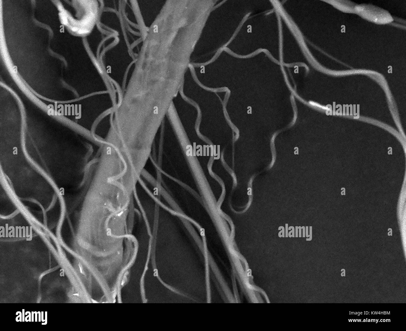 Microscopio electrónico de barrido (SEM) micrografía mostrando la araña de seda, con un aumento de 2500x, 2016. Foto de stock