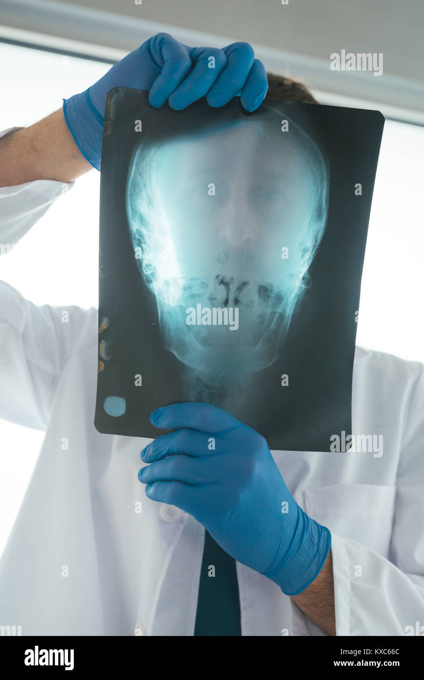 Médico examina radiografía de cráneo del paciente en una clínica. Profesional de la salud analizando pruebas de imagen de la cabeza humana. Foto de stock