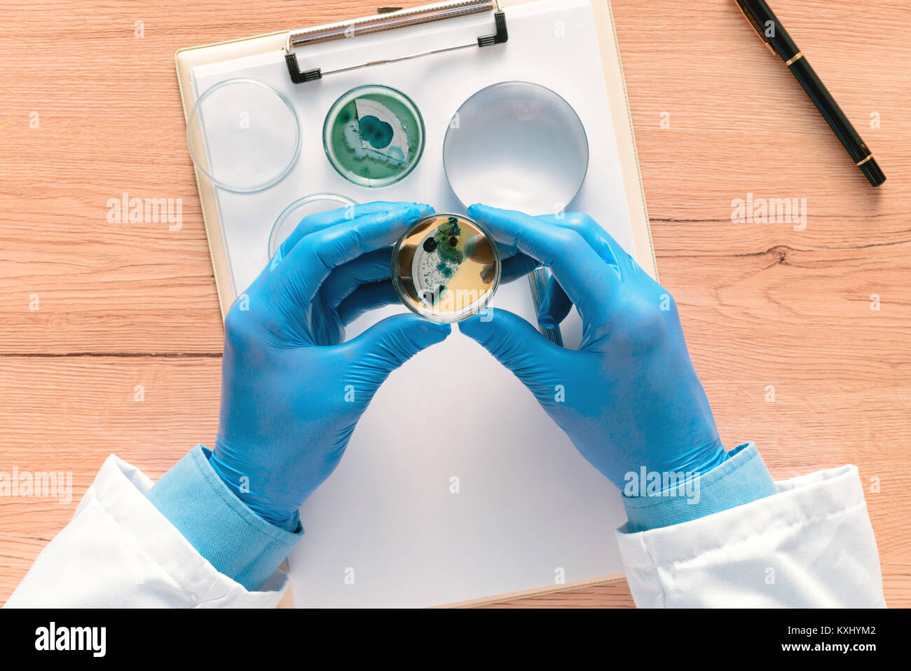 Vista aérea de técnico de laboratorio de análisis de crecimiento de cultivos bacterianos en placa de Petri, ciencia y antecedentes de microbiología Foto de stock