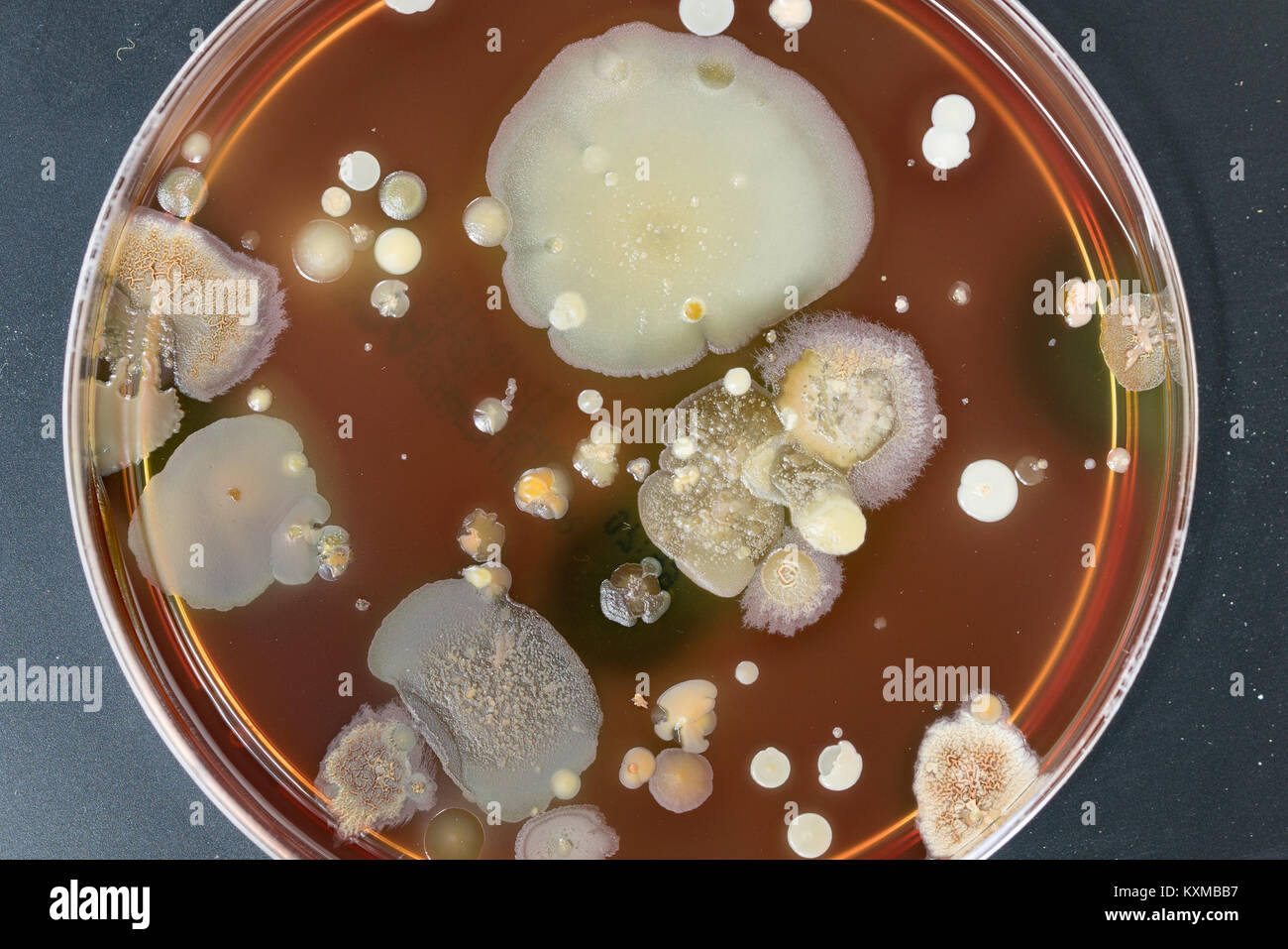 Una caja de petri con las colonias de microorganismos para análisis  bacteriológico en un laboratorio microbiológico Fotografía de stock - Alamy