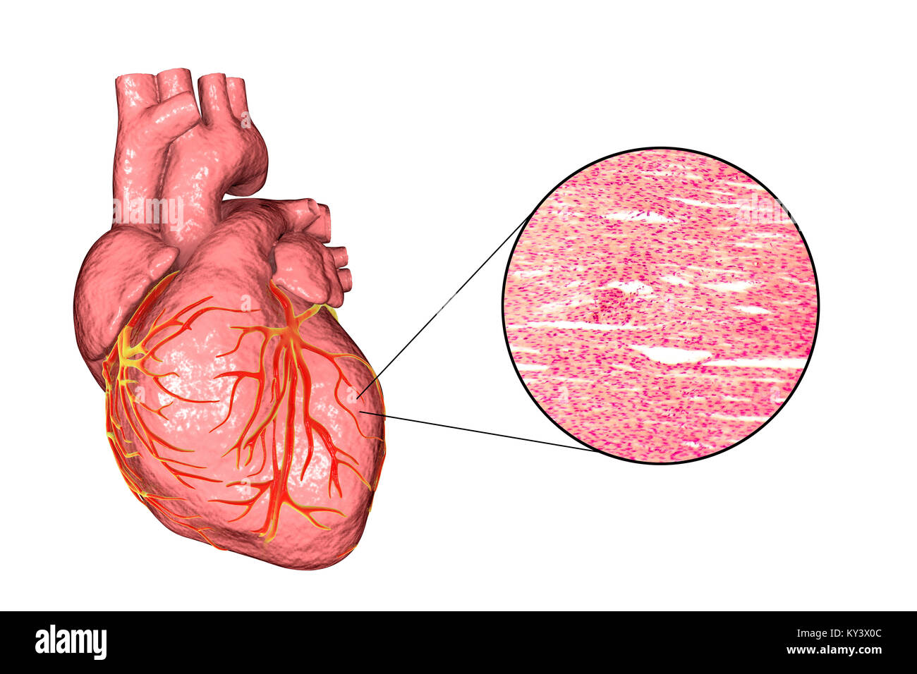 Equipo ilustración de un corazón humano y Micrografía de luz del músculo del corazón. El músculo cardíaco está formado por células fusiformes agrupadas en paquetes irregulares. Los límites entre las células individuales son débilmente visible aquí. Cada celda contiene un núcleo, visibles como manchas de color oscuro. El músculo cardíaco es un tejido muscular especializado que pueden contraerse de forma regular y continua, sin cansancio. Foto de stock
