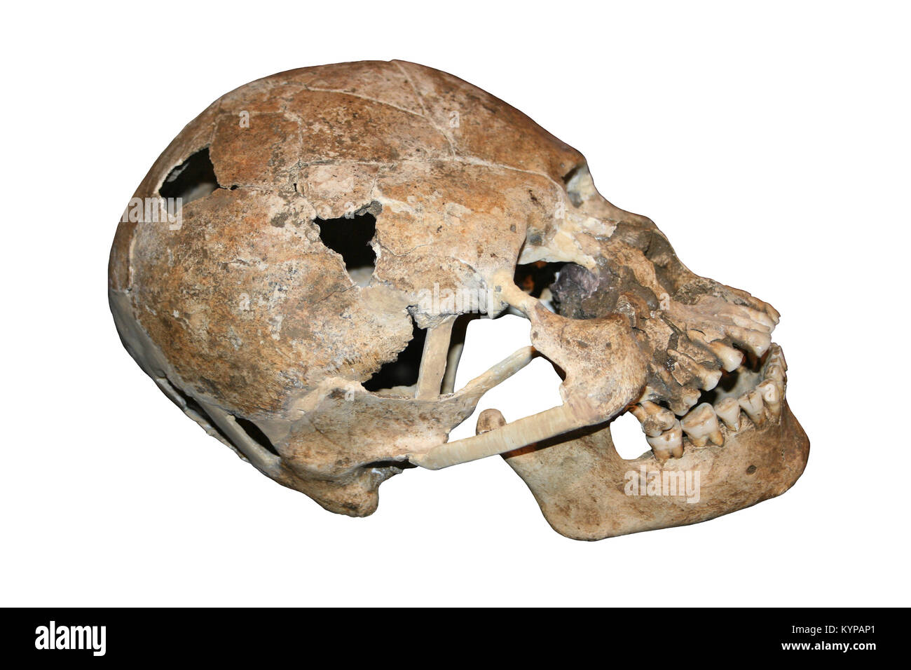 Cráneo alargado de Costa Rica Foto de stock