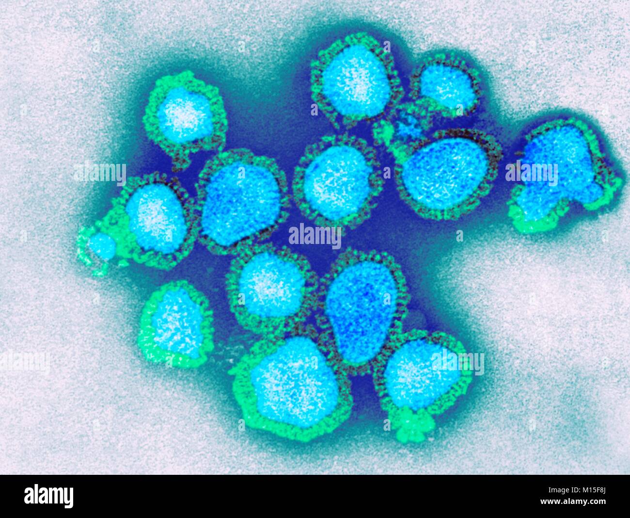 H3N2 del virus de la influenza, las partículas coloreadas micrógrafo electrónico de transmisión (TEM). Cada virus consiste de una capa de proteína (nucleocapsid) que rodea un núcleo de ARN (ácido ribonucleico) material genético. El nucleocapsid circundante es un sobre que contiene lípidos picos de la glicoproteína hemaglutinina (H) y la neuraminidasa (N). Estos virus fueron parte de la pandemia de gripe de Hong Kong de 1968-1969, que causó la muerte de aproximadamente un millón en todo el mundo. H3N2 virus son capaces de infectar a las aves y los mamíferos, así como los seres humanos. Foto de stock