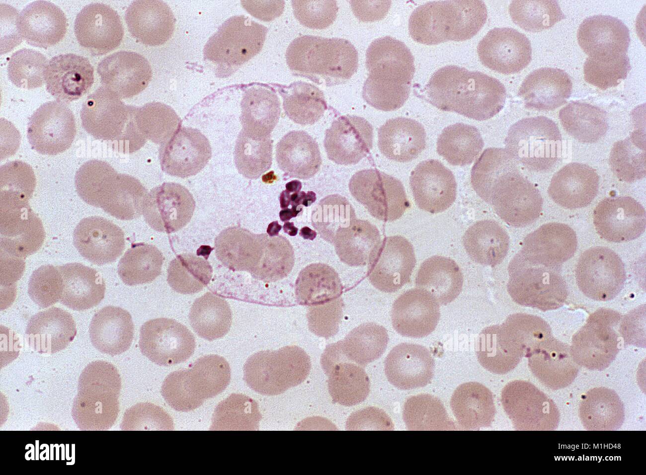 Photomicrogragh Del Parásito De La Malaria Plasmodium Ovale En Su Etapa Schizont Maduras 2880