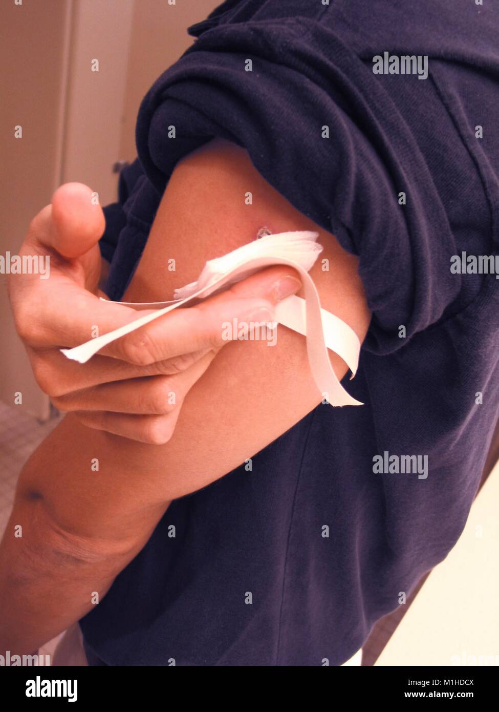Un hombre sobre la viruela vacuna con el vendaje de gasa, cerca, en el baño, en los Centros de Control de Enfermedades (CDC), de Atlanta, Georgia, 2003. () Foto de stock