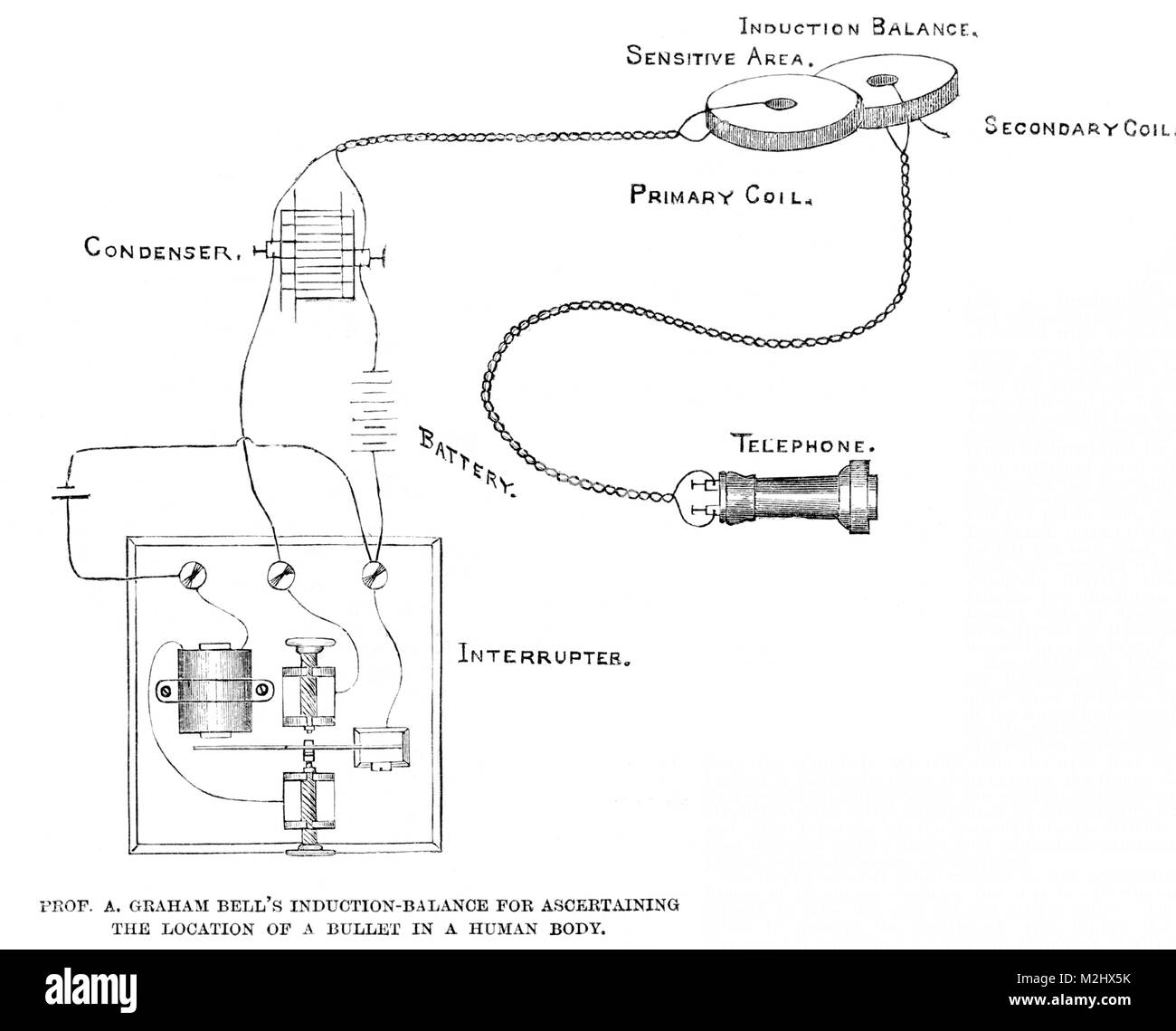 Alexander Graham Bell, el detector de metales, 1891 Fotografía de stock -  Alamy