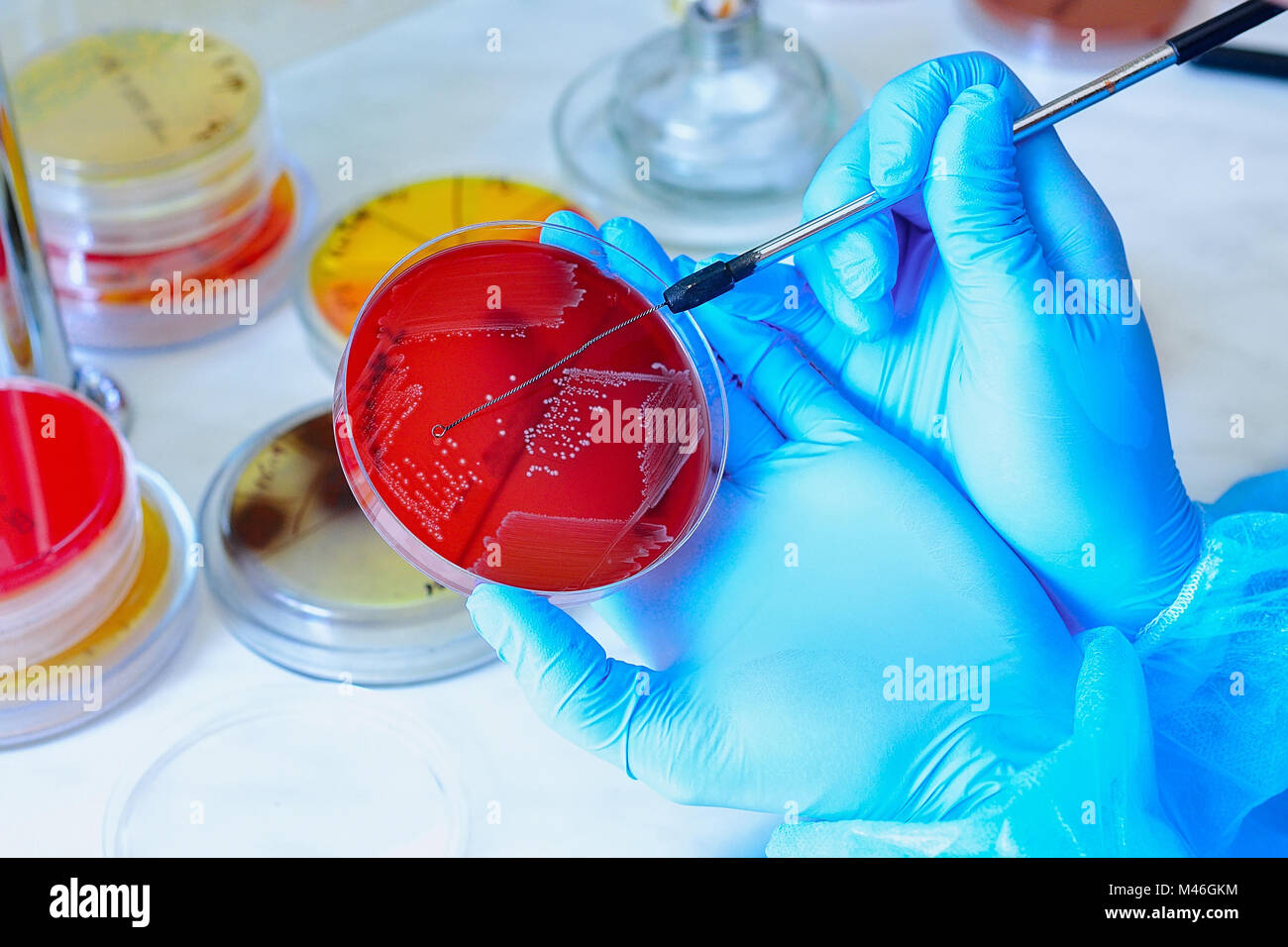 Placa de Petri. Laboratorio Microbiológico. Cultivos de hongos y moho. Investigación bacteriana Foto de stock