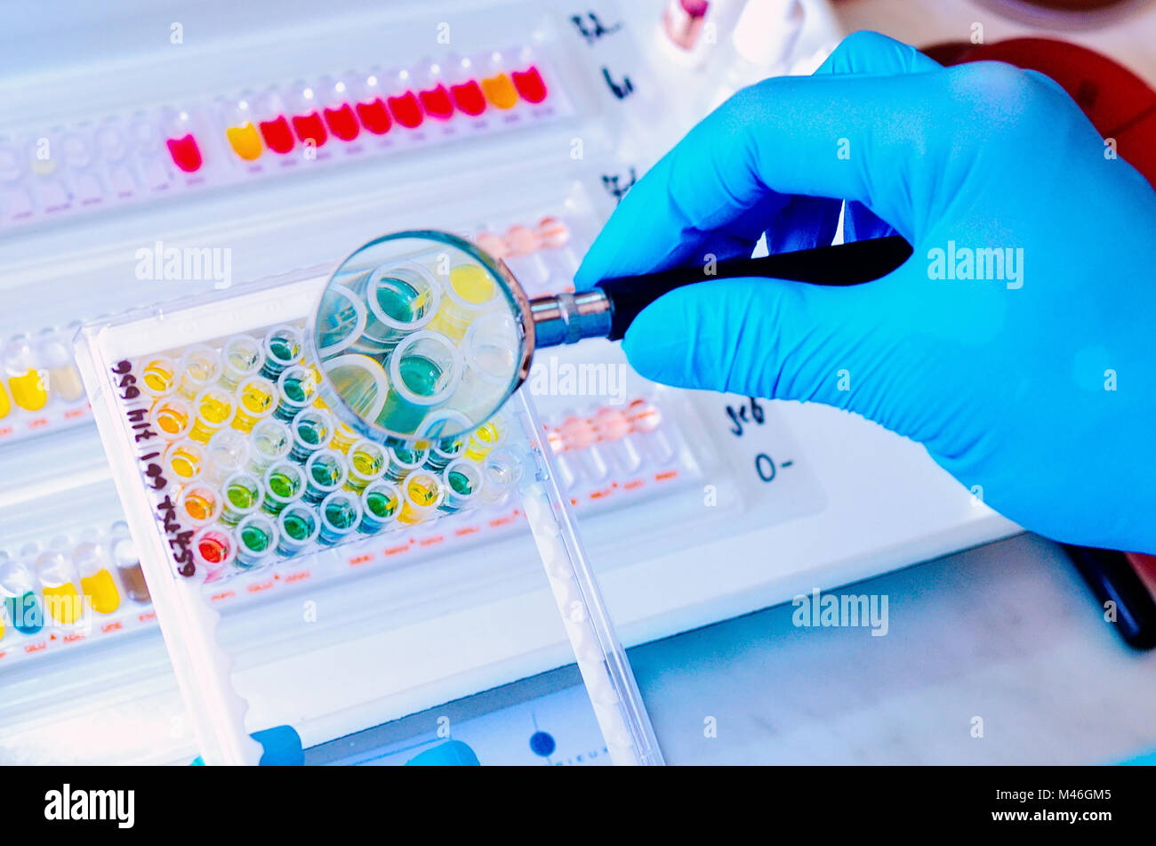 Placa de Petri. Laboratorio Microbiológico. Cultivos de hongos y moho. Investigación bacteriana Foto de stock