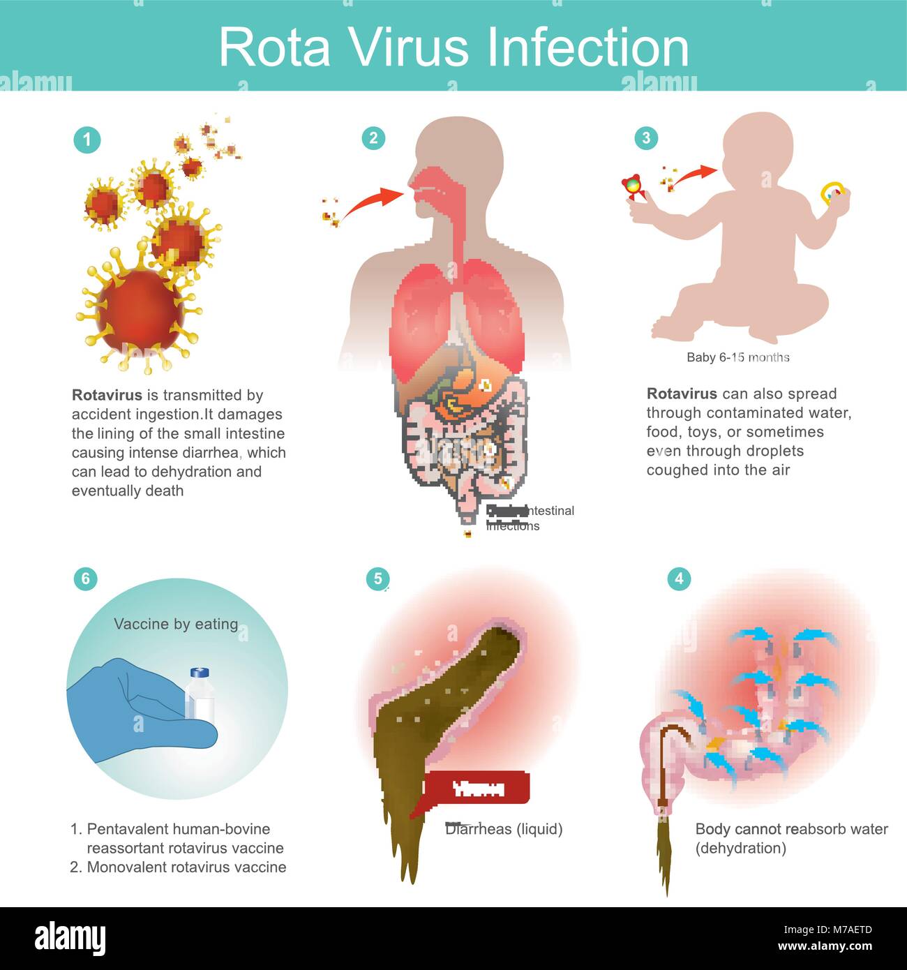 El rotavirus se transmite por la ingestión accidental. Luego se daña el revestimiento del intestino delgado y causando intensas diarreas que pueden conducir t Ilustración del Vector