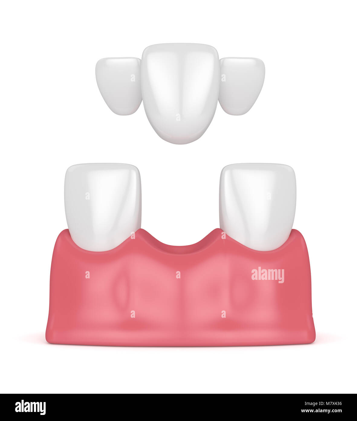NQEUEPN Caja de dientes de madera, lindo diente blanco 3D imagen