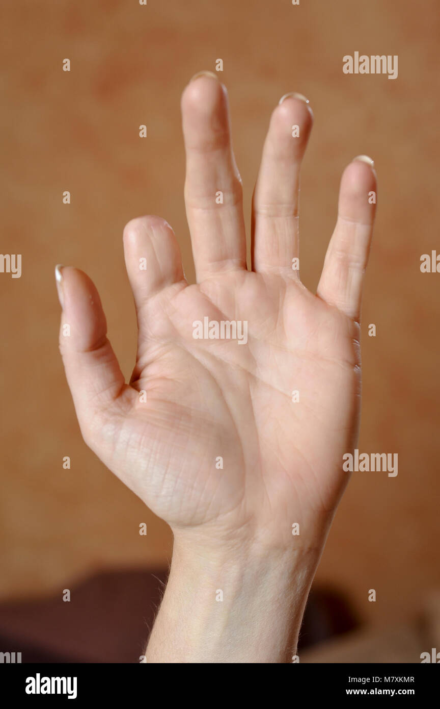 Mano sin dedos fotografías e imágenes de alta resolución - Alamy