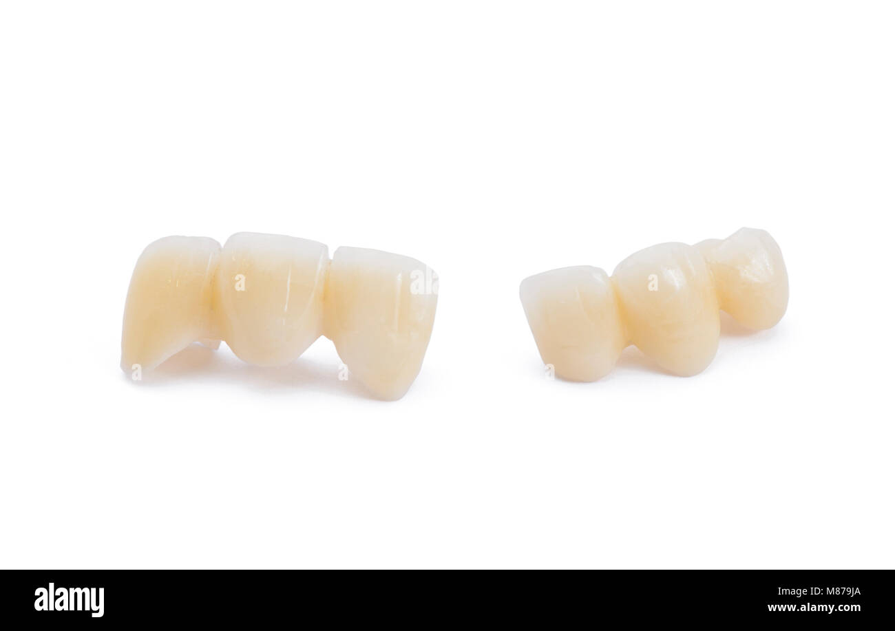 Dentaduras de cerámica sobre fondo blanco Fotografía de stock - Alamy