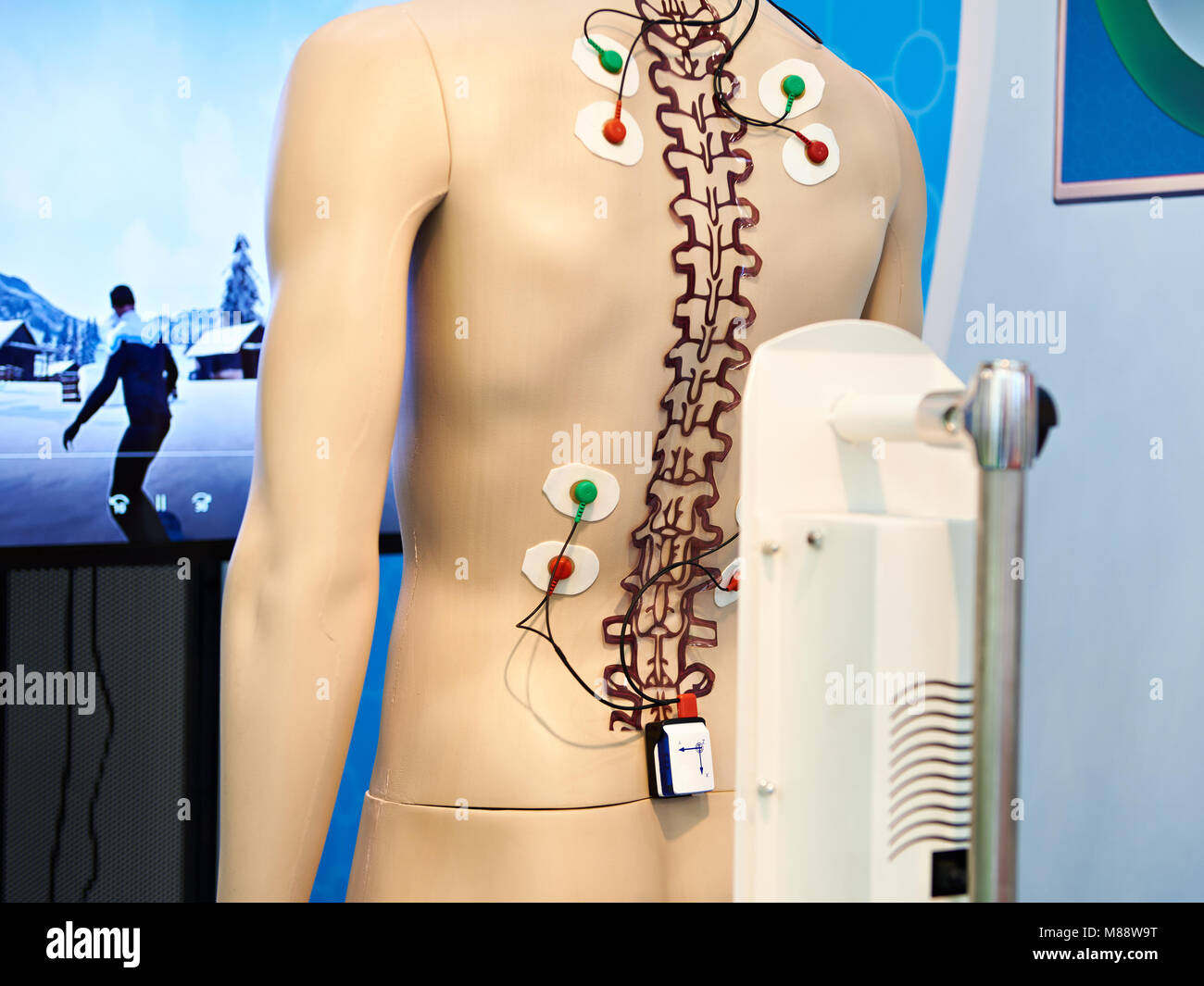 Equipos médicos con sensores biomecánicos para la rehabilitación de  pacientes con problemas musculoesqueléticos Fotografía de stock - Alamy