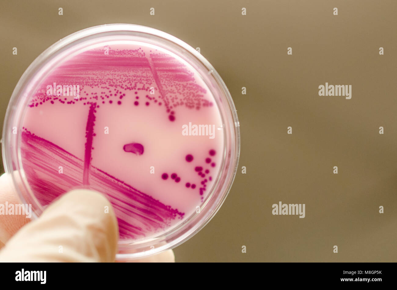 Placa de cultivo bacteriano sosteniendo en la mano Foto de stock