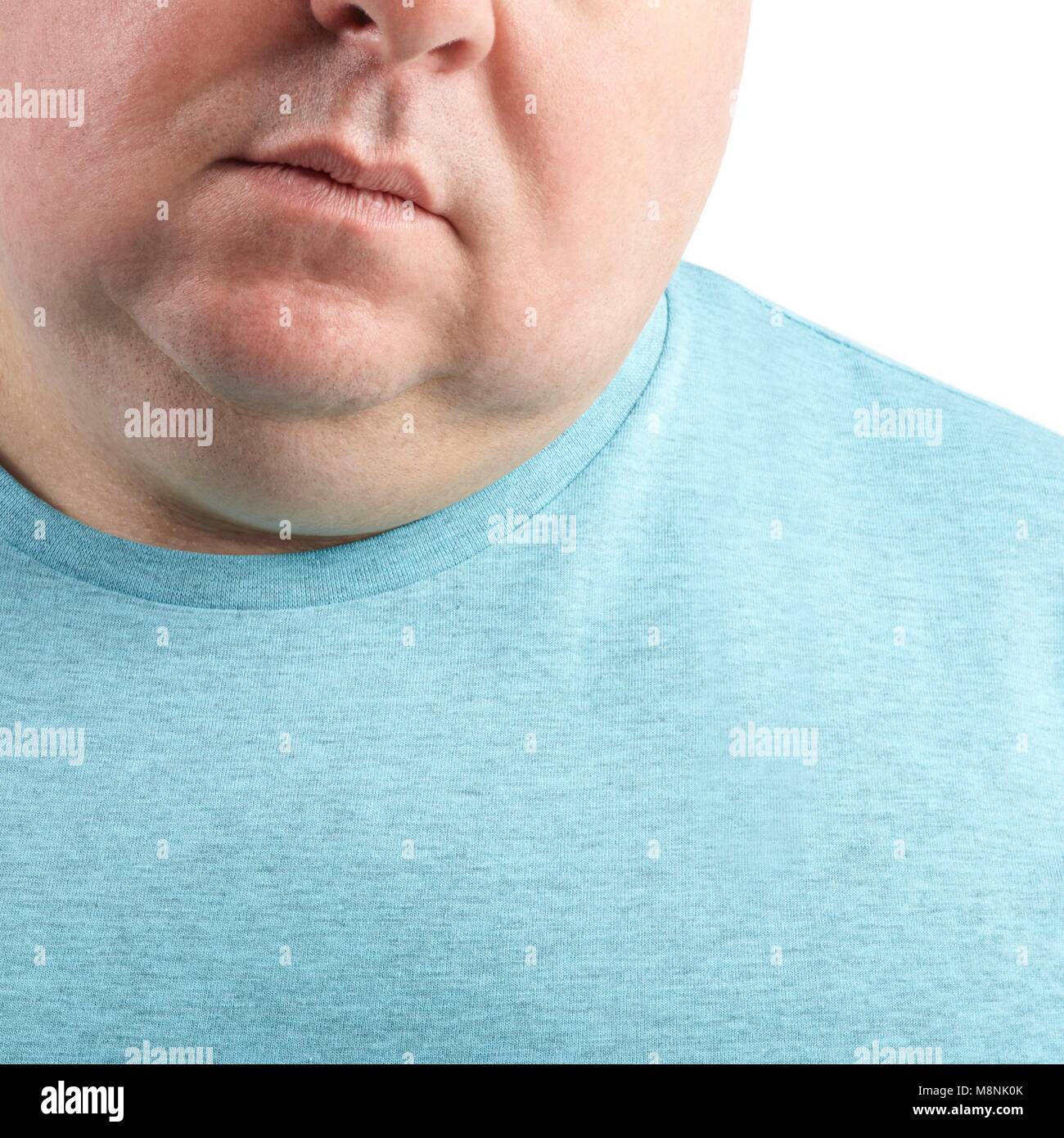 Cerca de sobrepeso del hombre recortada con la barbilla y el cuello. Foto de stock
