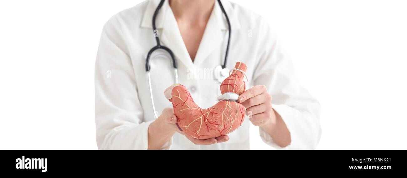 Médico con un modelo médico del estómago humano con una banda gástrica. Foto de stock