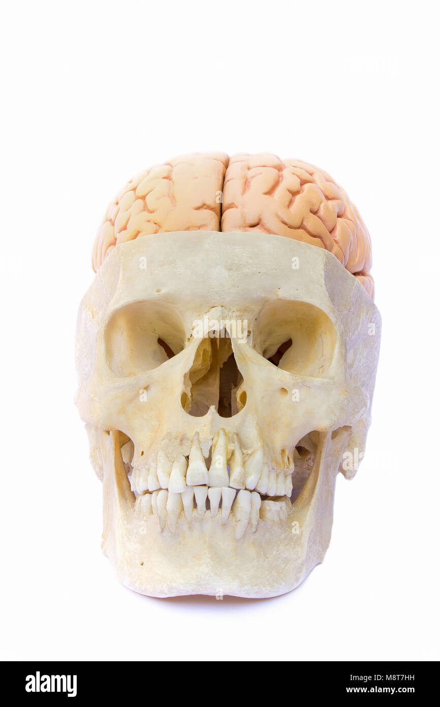Cráneo humano lleno de cerebros artificiales aislado sobre fondo blanco. Foto de stock