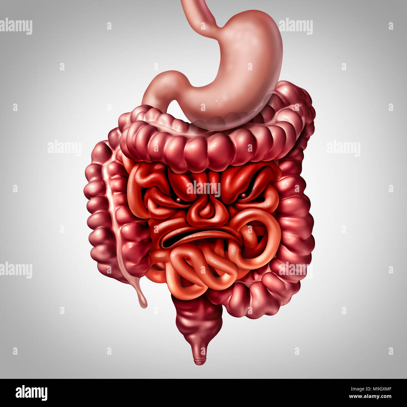 Síndrome del intestino irritable Síntomas y diagnóstico del intestino y el colon y el dolor como la inflamación de los intestinos en forma de un enojo. Foto de stock