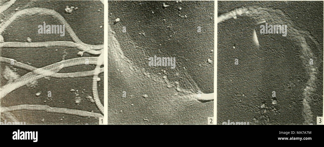 Microscopía electrónica; actas de la Conferencia de Estocolmo, septiembre  de 1956 . Las Figs. 1-3. Cambios morfológicos en fibrillas de colágeno  producido por la papaina la digestión. Fig. 1. Plana, como