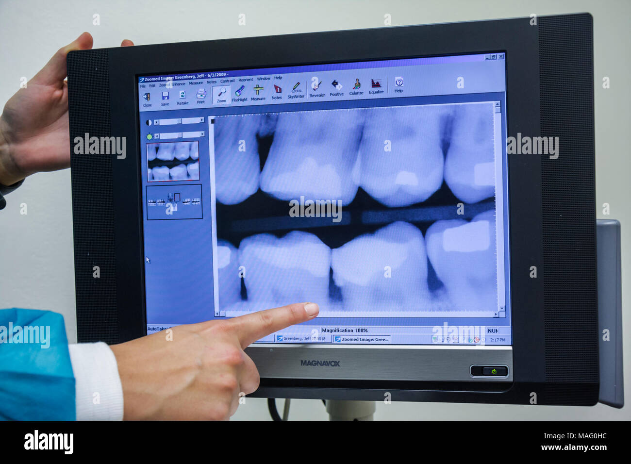 Miami Florida,Coral Gables,rayos X,radiología,dental,dentista