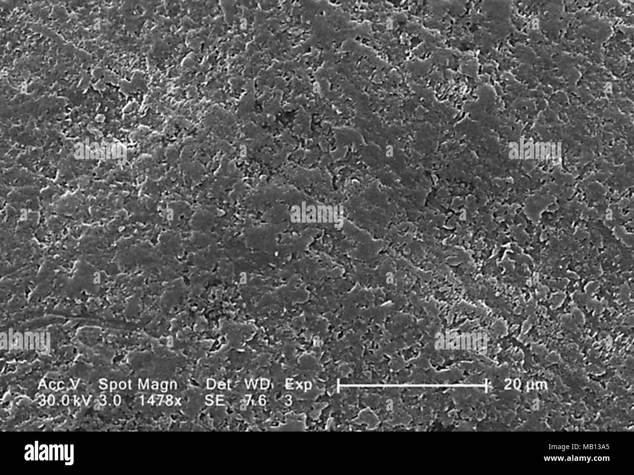 Superficie rugosa de un espécimen de la especie Vitis uva de mesa blanco reveló en el 1478 x magnificada análisis microscópico de electrones (SEM) de imagen, 2005. Imagen cortesía de los Centros para el Control de Enfermedades (CDC). () Foto de stock