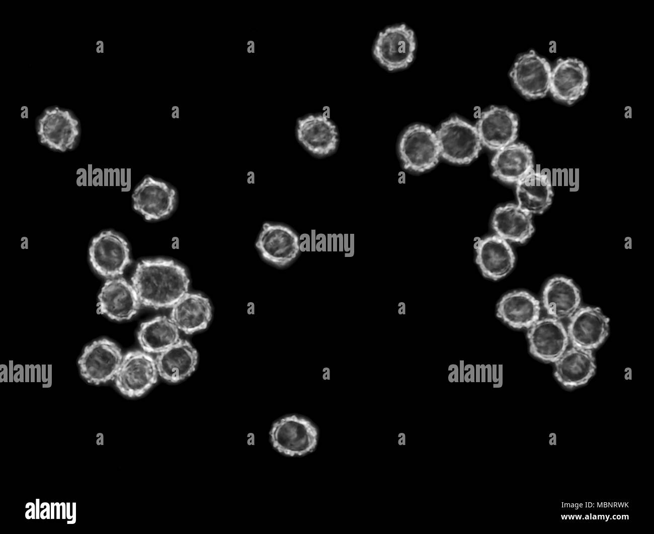 Luz de campo oscuro micrografía de Lactarius milkcap rubrilacteus (sangrado) esporas de setas, foto de superficie es de unos 120 micrones de ancho Foto de stock