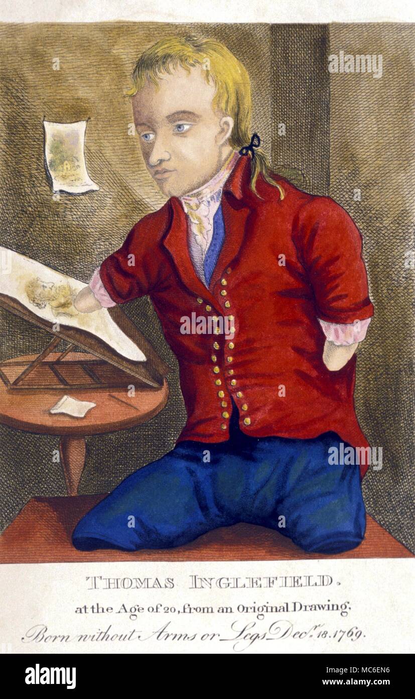 Thomas Inglefield fenómenos extraños a la edad de 20 años. Inglefield nació sin brazos o piernas en 1769, pero se convirtió en un hábil artista. Fecha de impresión 1804 por Kirby Foto de stock