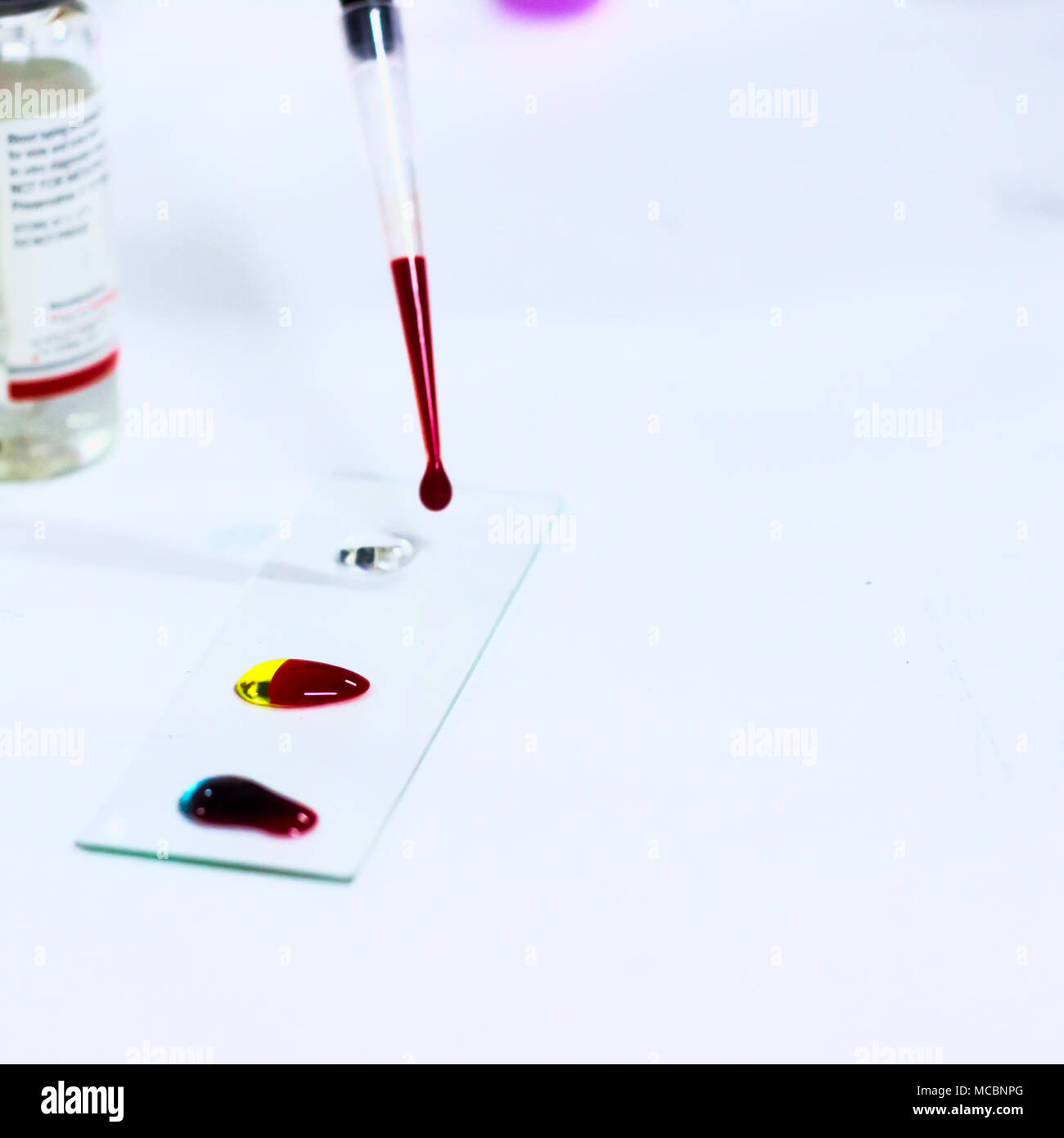 Gota De Sangre Sobre Portaobjetos De Vidrio Para Los Grupos Sangu neos 