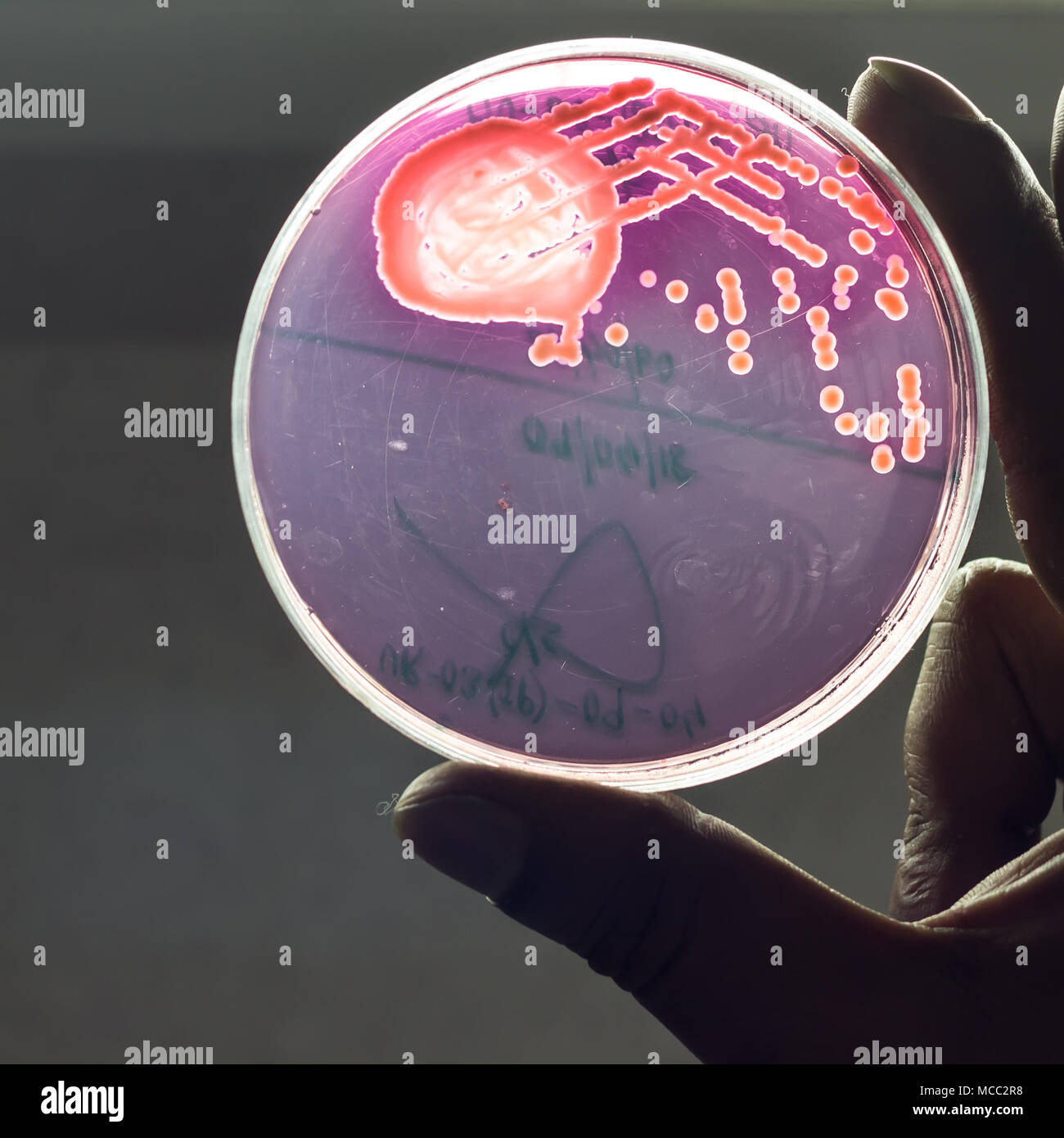 Placa de cultivo bacteriano mostrando crecimiento de colonias bacterianas en Mac Conkey agar sangre celebró a mano Foto de stock
