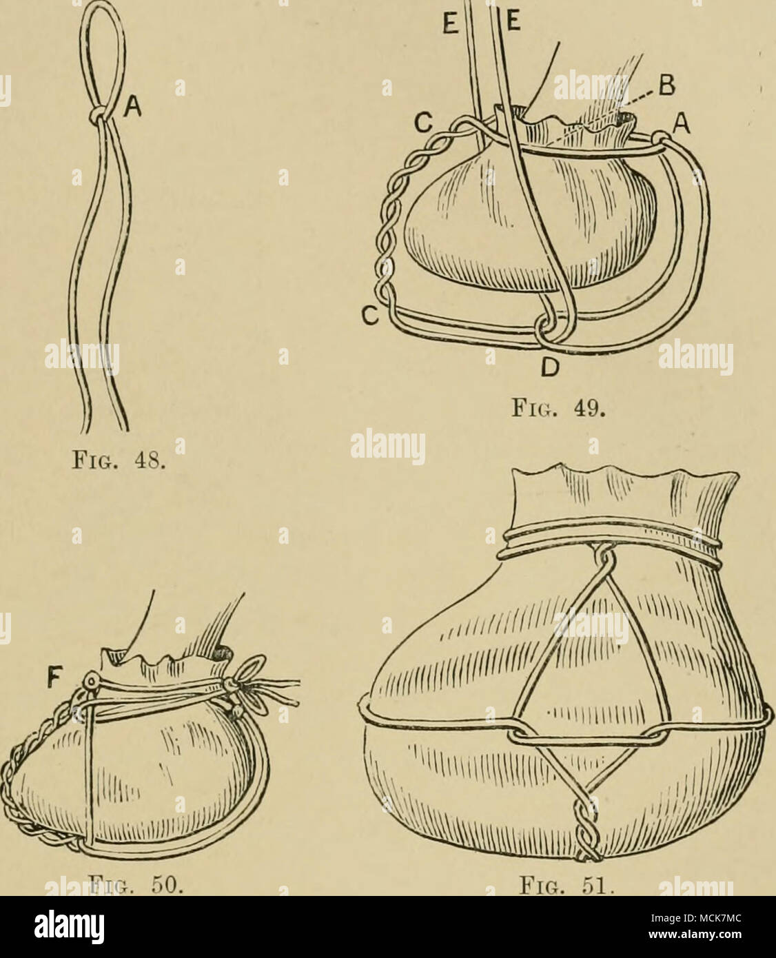 . Las Figs. 48, 49, 50, 51.-ilustrando el Teniente Coronel Nunn del método de aplicar una cataplasma para el pie del cordón (GC, Fig. 49), pasan a través del bucle (como en "D", Fig. 49) y, a continuación, bien apretada. Los extremos del cable ahora están separadas y llevado hasta la coronilla (como en EE, Fig. 49), uno en el exterior y la otra en la parte interior del pie. Luego son nuevamente ronda trenzados entre sí una vez o dos veces (como en F, Fig. 50), y se pasa a la vuelta de la cuartilla una o dos veces en cada lado. Ellos son ahora transferidos bajo Foto de stock