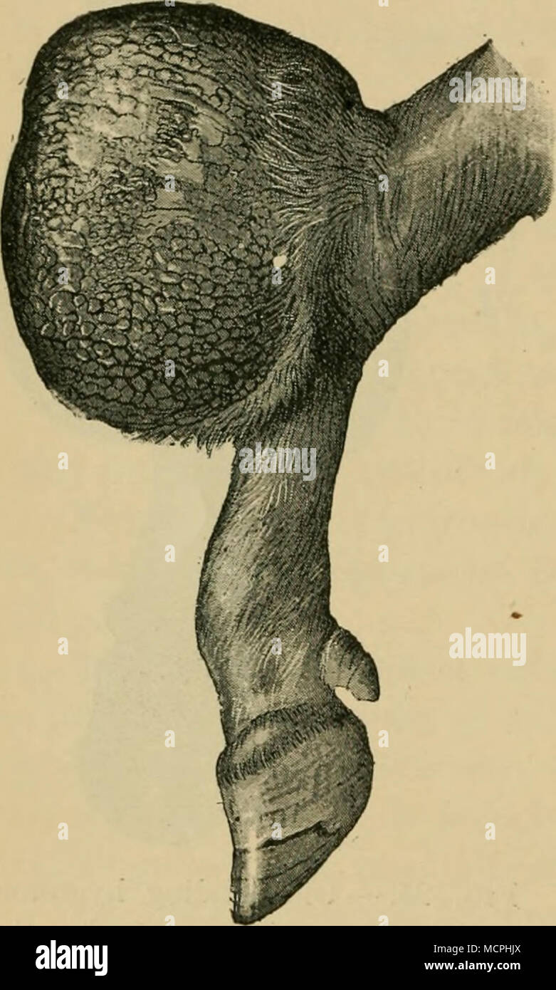 . Fig. 26.-Higroma de la rodilla. La piel ha sufrido su conversión en una sustancia parecido a la bocina. Foto de stock