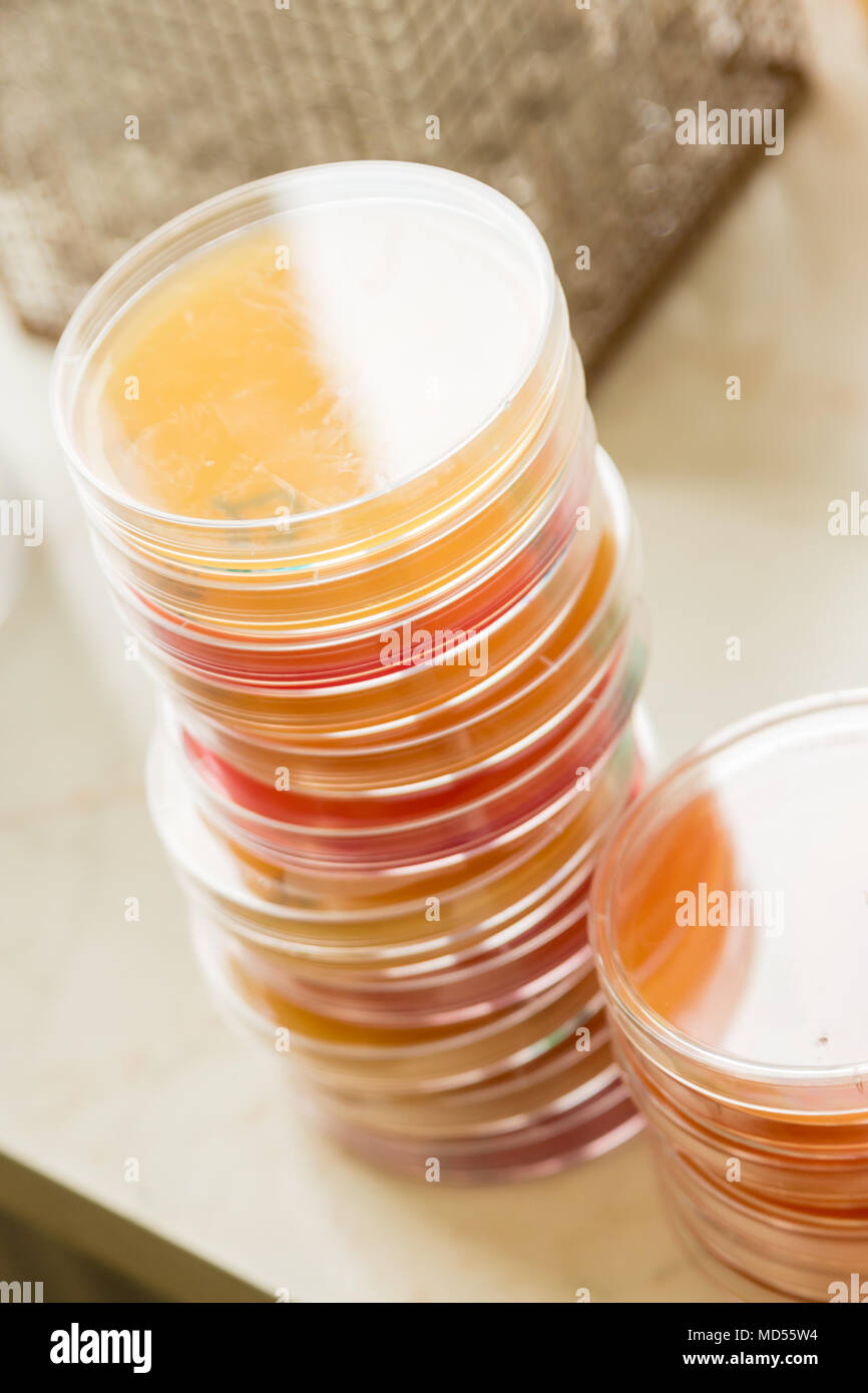 Montón de petri con cultivos de microorganismos crecen en sustrato de naranja y rojo. Foto de stock
